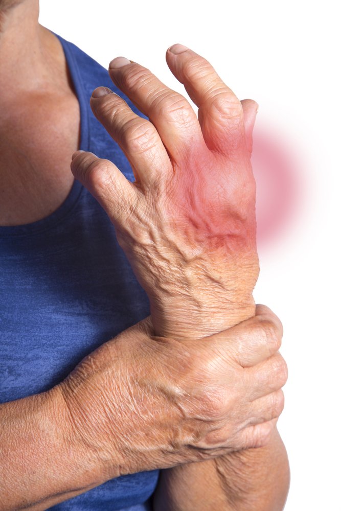 Osteoarthritis