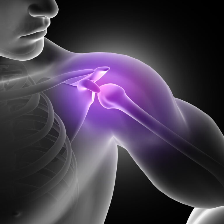 3D illustration of the shoulder joint highlighted in pain